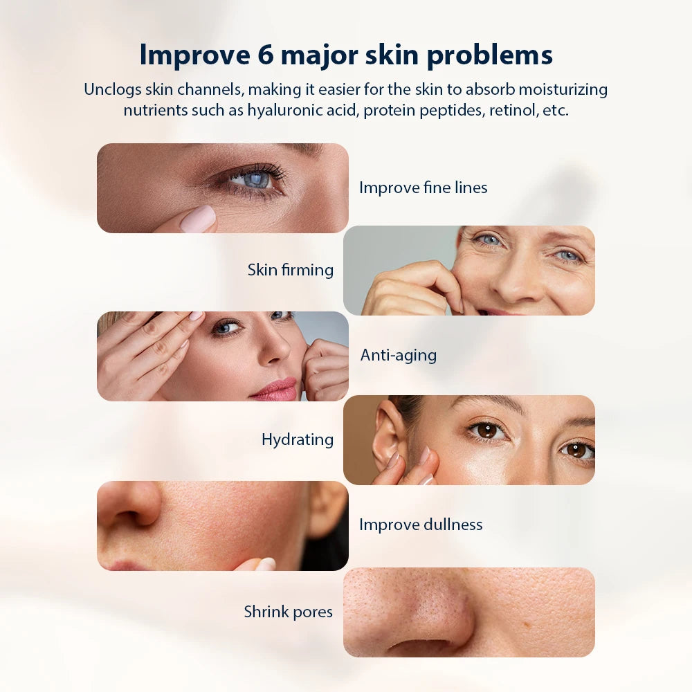 Portable Handheld Rechargeable Exfoliate Device Facial Machine