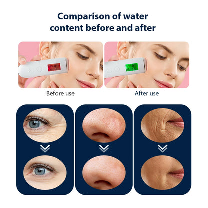 Portable Handheld Rechargeable Exfoliate Device Facial Machine